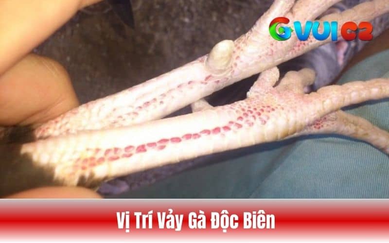 Các vị trí vảy gà độc biên thường mọc