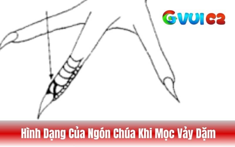 Hình dạng của ngón chúa khi mọc vảy dặm Hình dạng của ngón chúa khi mọc vảy dặm